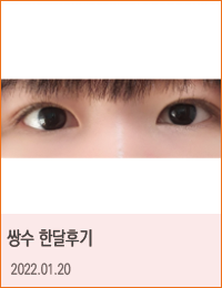 링크성형외과_케이스사진(네이버카페)리얼후기_리얼찐후기_네이버카페_후기리뷰_쌍꺼풀수술_10