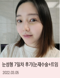 링크성형외과_케이스사진_14