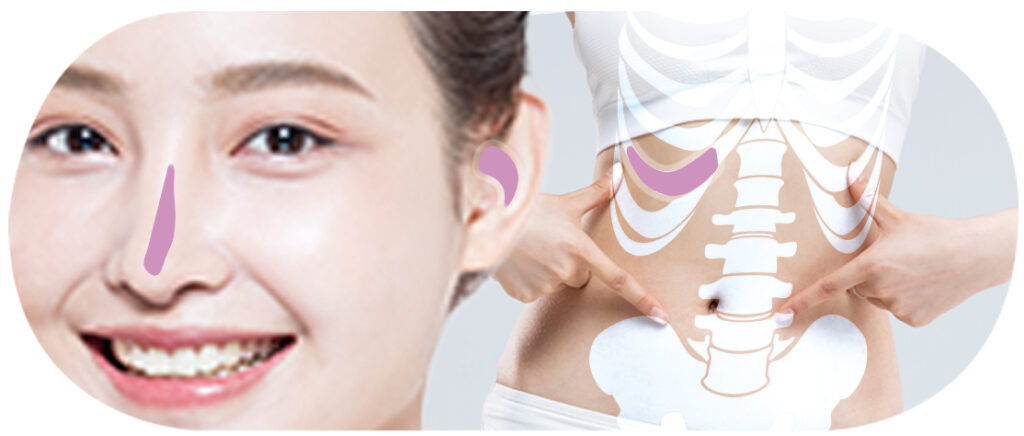 코성형 보형물 종류_자가조직_링크성형외과_성하민원장_정민수원장