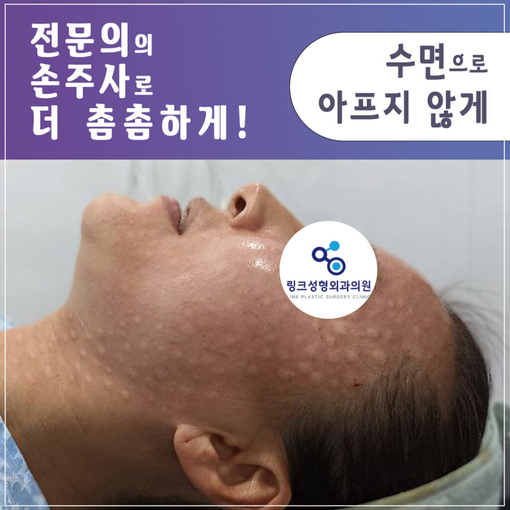 리쥬란_리쥬란힐러_수면리쥬란_리쥬란효과_리쥬란비용_2_리쥬란 실제 후기