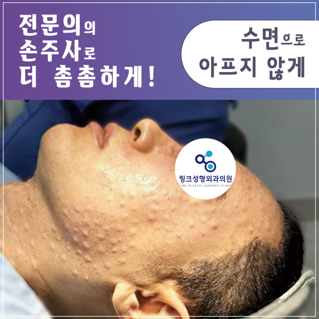 리쥬란_리쥬란힐러_수면리쥬란_리쥬란효과_리쥬란비용_4_리쥬란 실제 후기