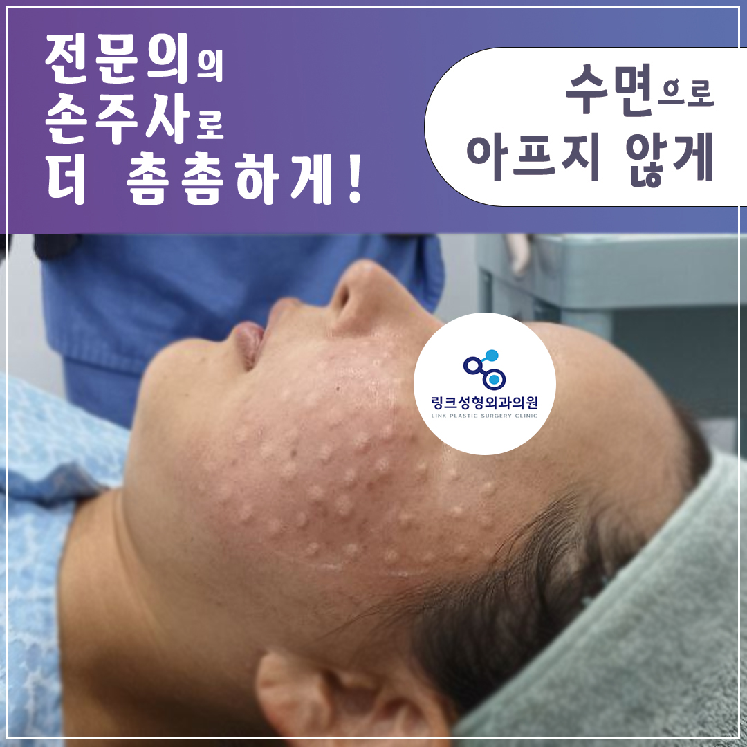 리쥬란_리쥬란힐러_수면리쥬란_리쥬란효과_리쥬란비용_5_리쥬란 실제 후기