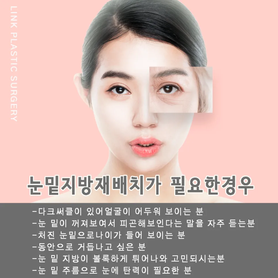눈밑지방재배치 관련 이미지