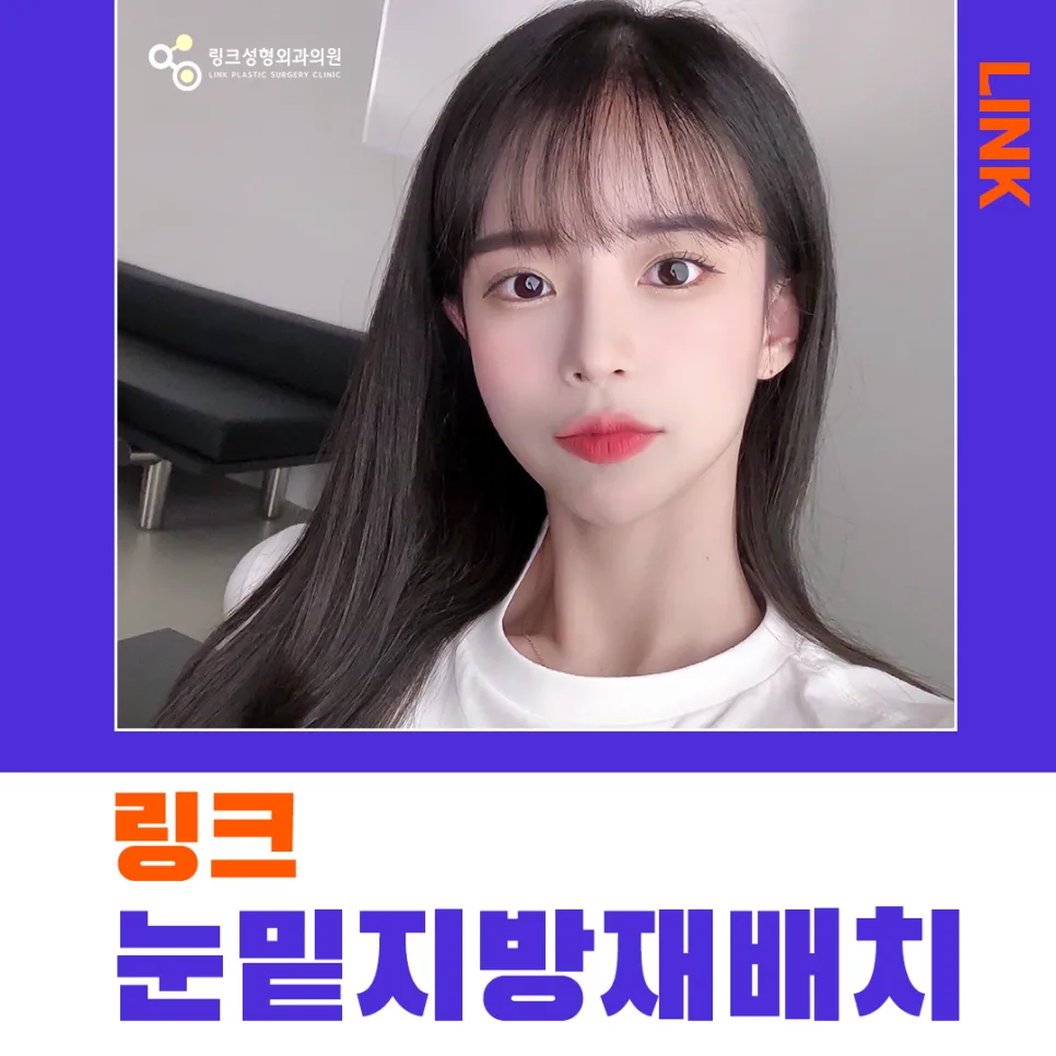 눈밑지방재배치 관련 이미지