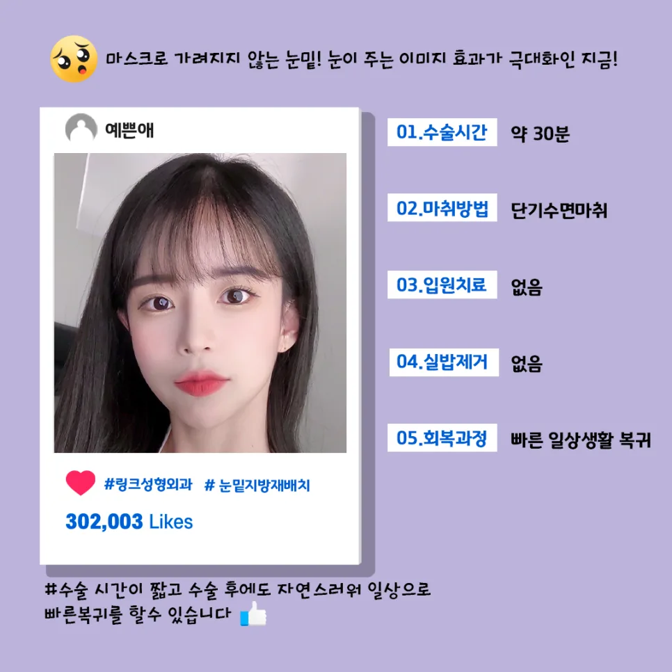 눈밑지방재배치 관련 이미지