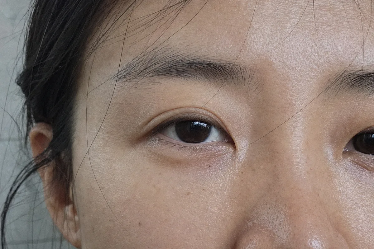 눈가탄력 관련 이미지