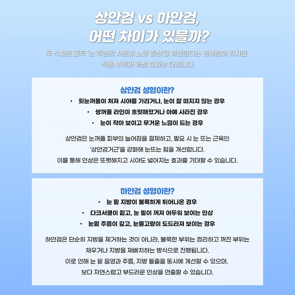 상안검 관련 이미지