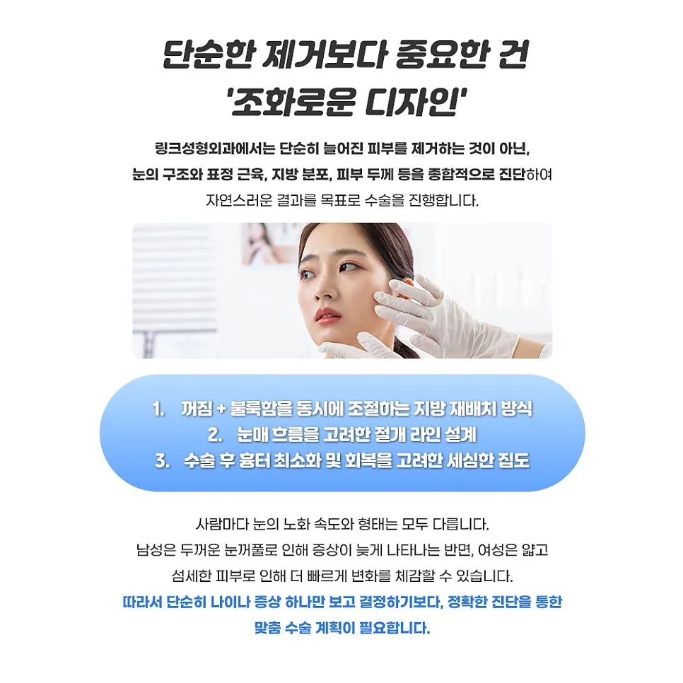 상안검 관련 이미지