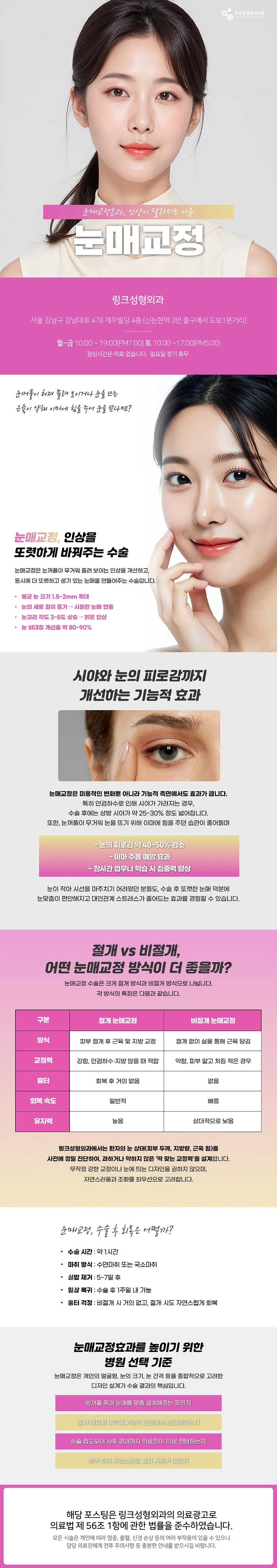 눈매교정 관련 이미지