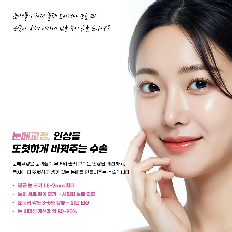 눈매교정 관련 이미지