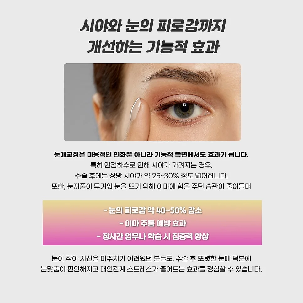 눈매교정 관련 이미지