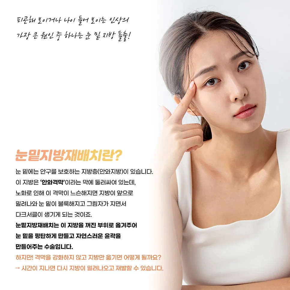 눈밑지방재배치 관련 이미지