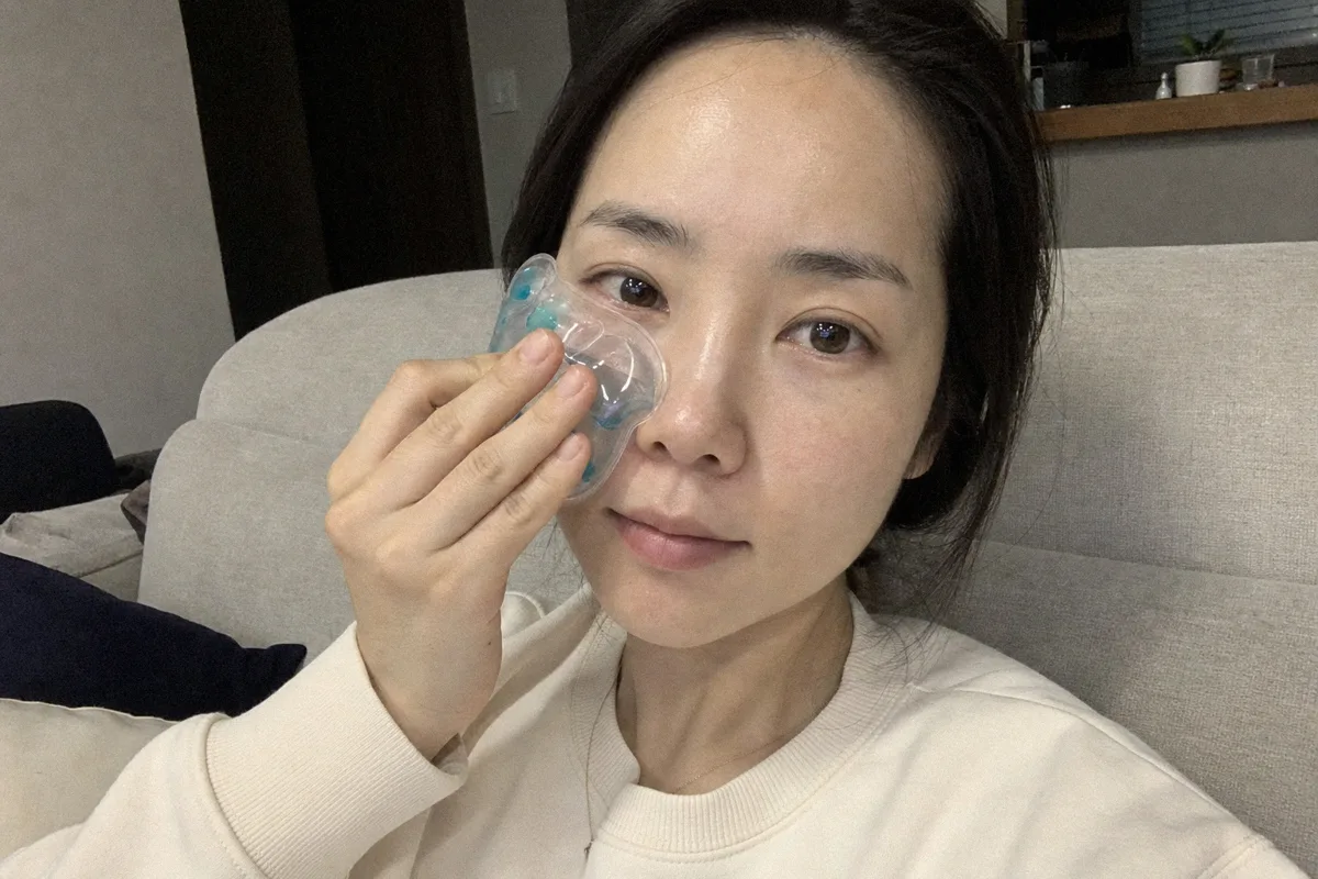 눈밑지방재배치 관련 이미지