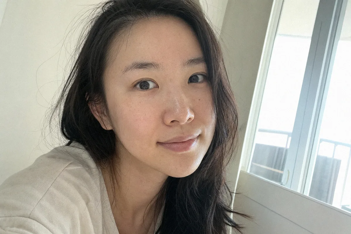 눈밑지방재배치 관련 이미지
