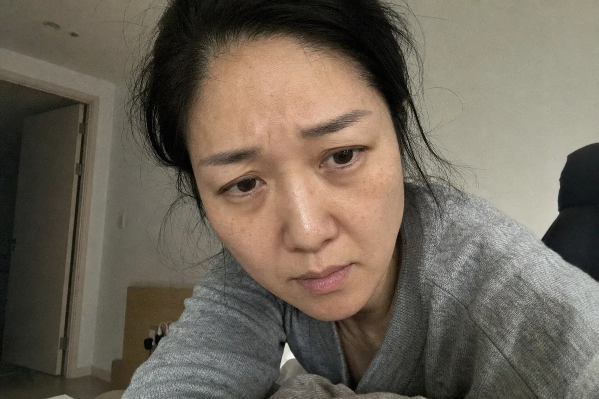 눈썹거상 관련 이미지