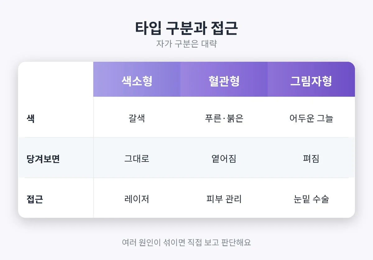 다크서클 관련 이미지