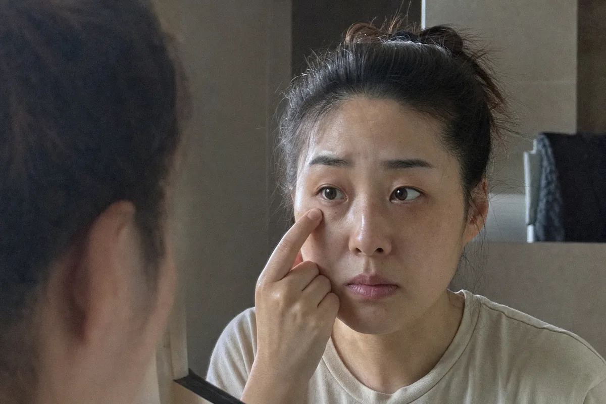 다크서클 관련 이미지