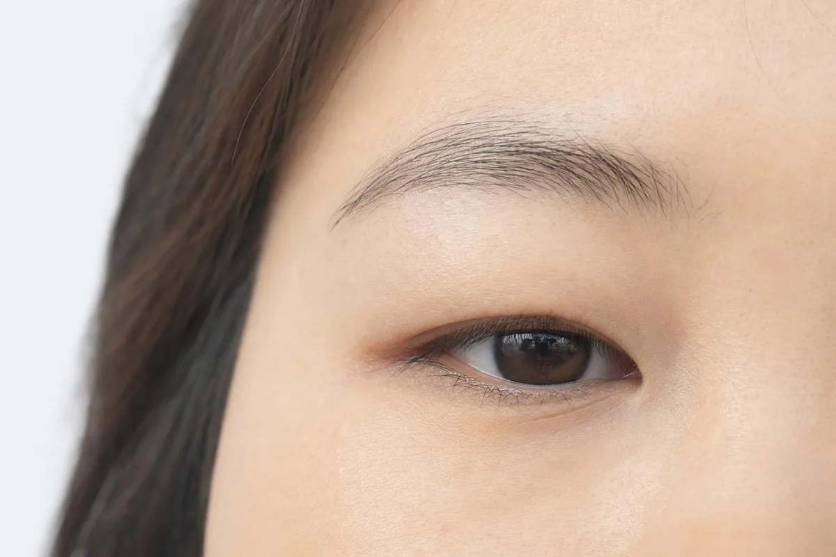 눈꺼풀지방제거 관련 이미지