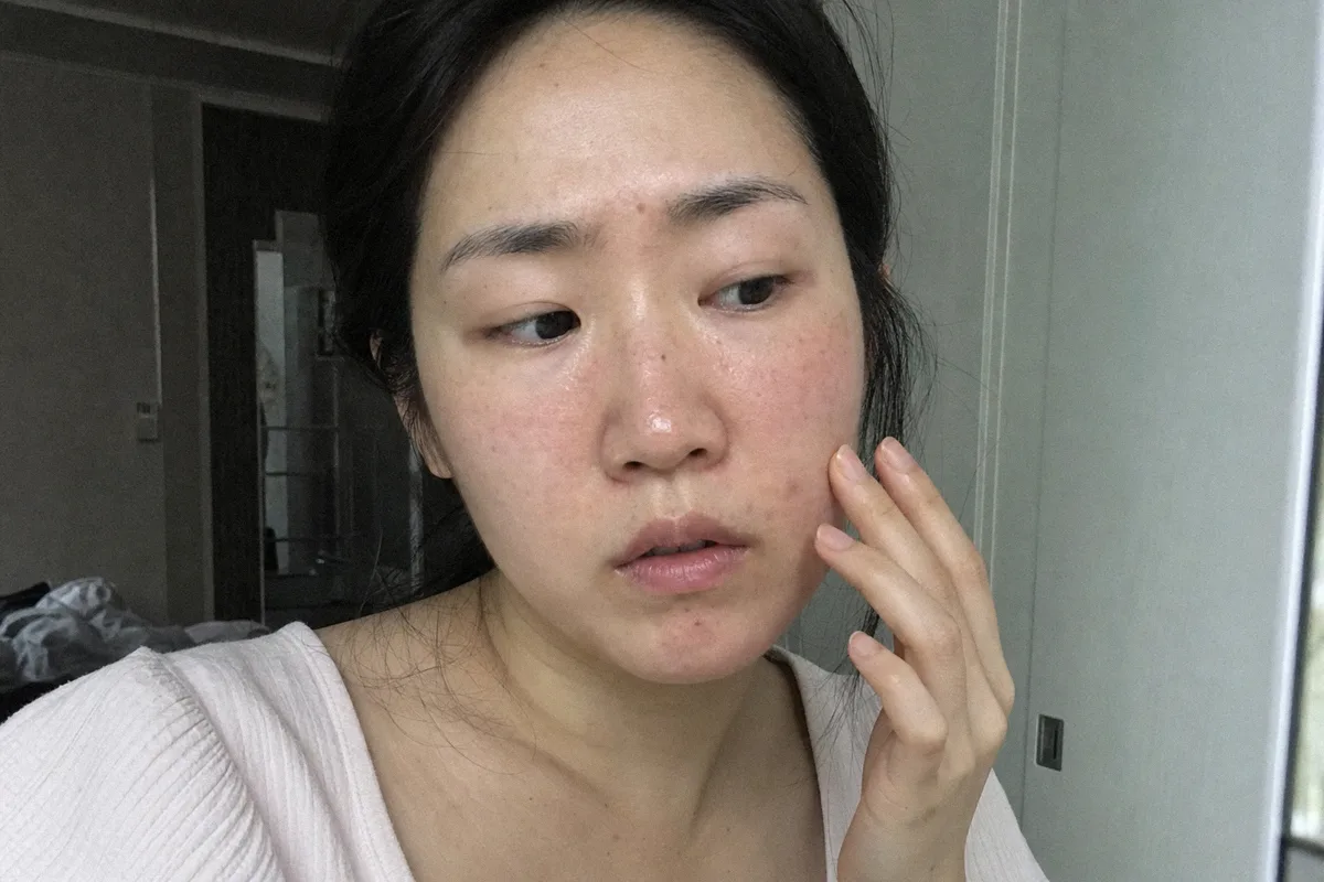 홍조 관련 이미지