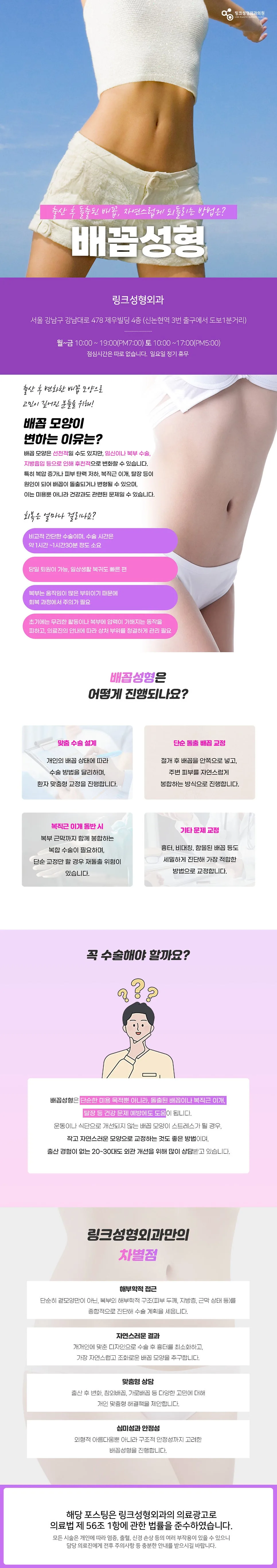 배꼽성형 관련 이미지