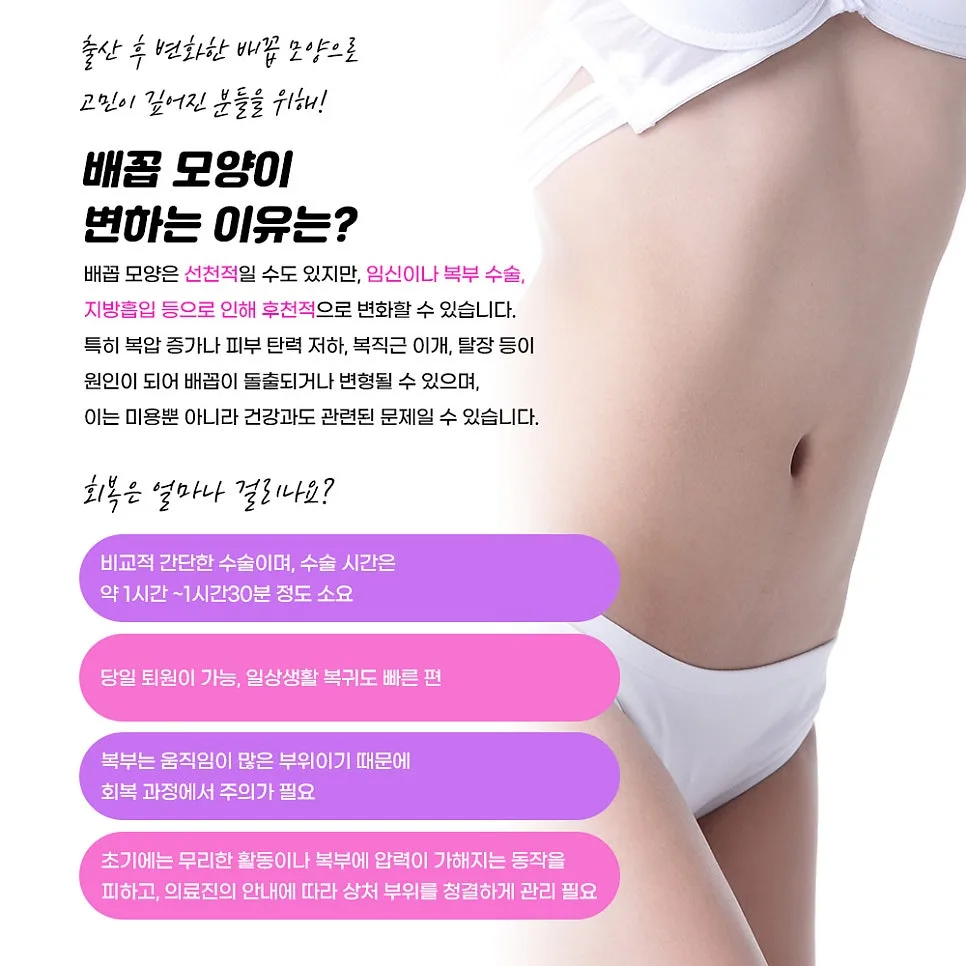 배꼽성형 관련 이미지