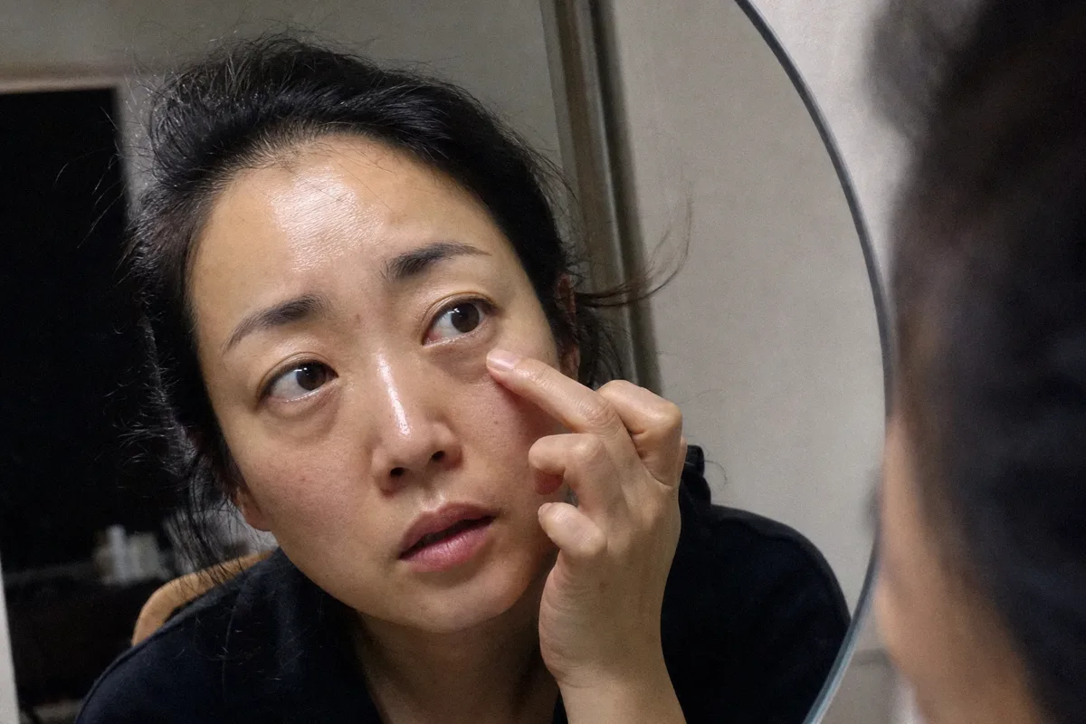 눈밑수술비교 관련 이미지