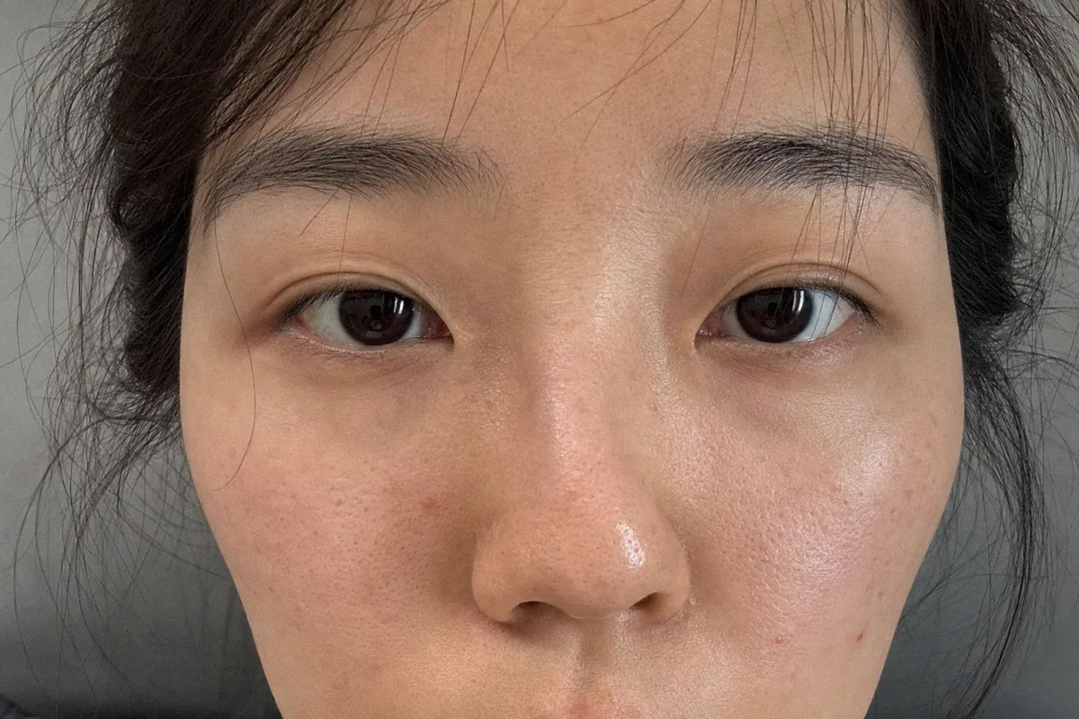 휜코 관련 이미지