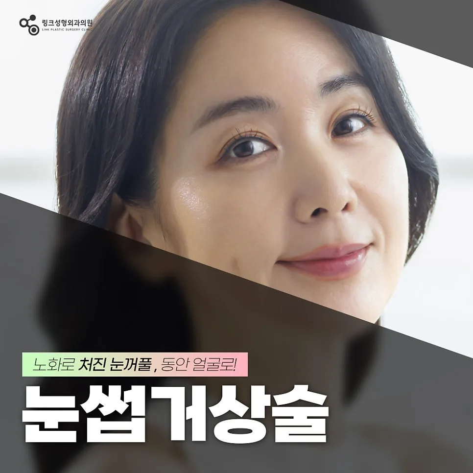 눈썹거상 관련 이미지
