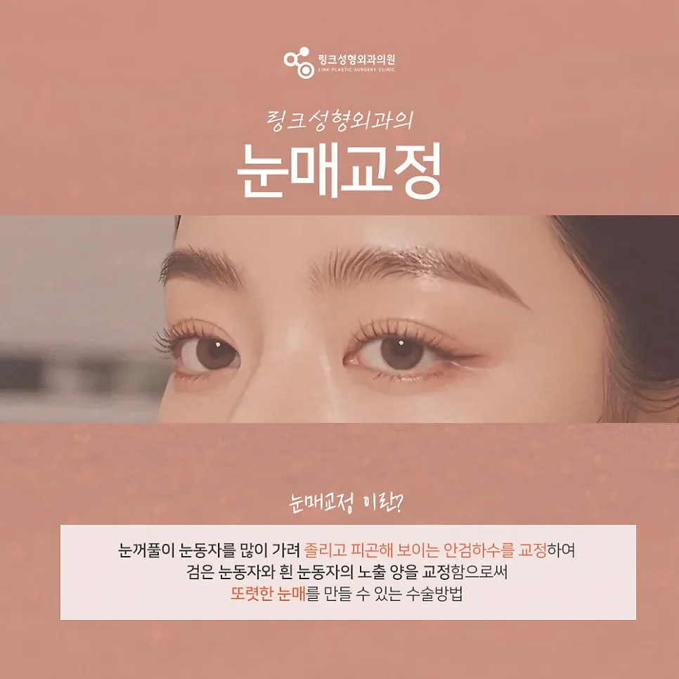 눈매교정 관련 이미지