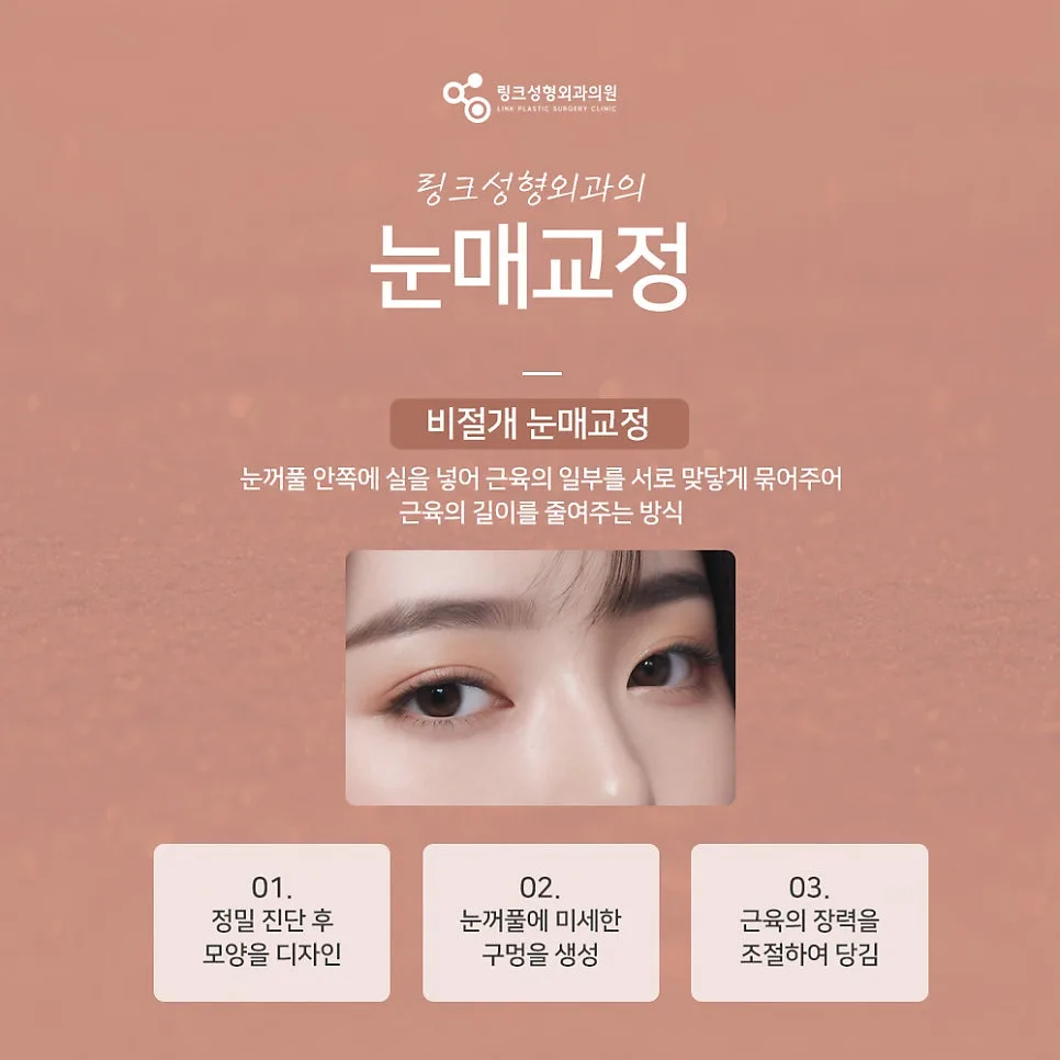 눈매교정 관련 이미지