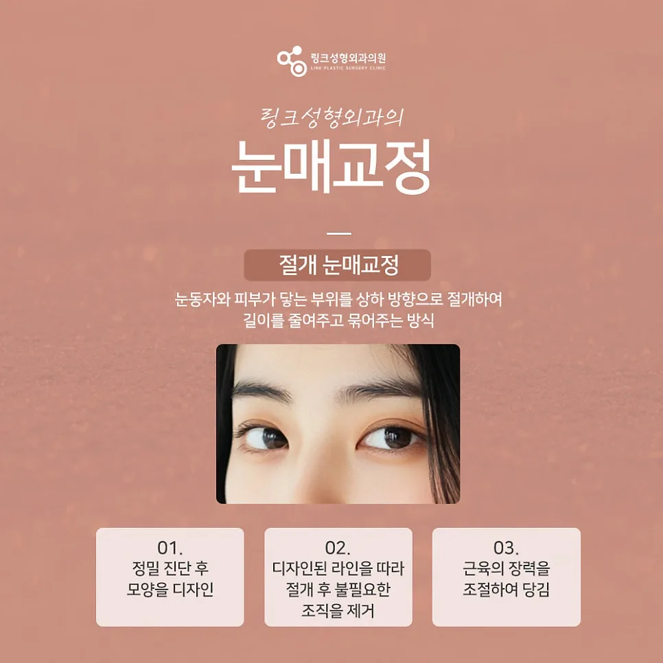 눈매교정 관련 이미지
