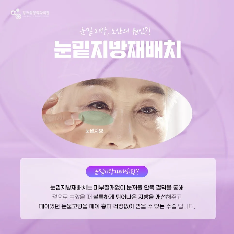 눈밑지방재배치 관련 이미지