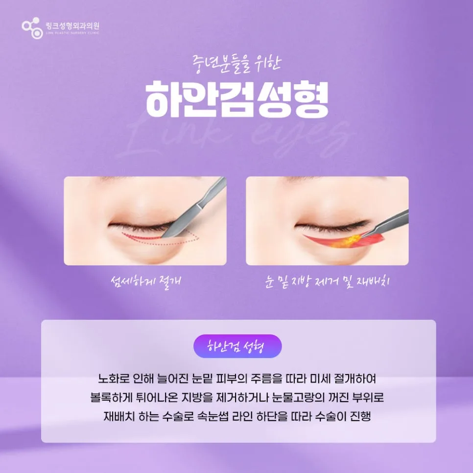 눈밑지방재배치 관련 이미지