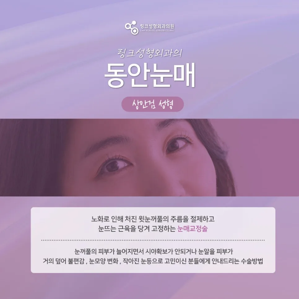 눈썹거상 관련 이미지