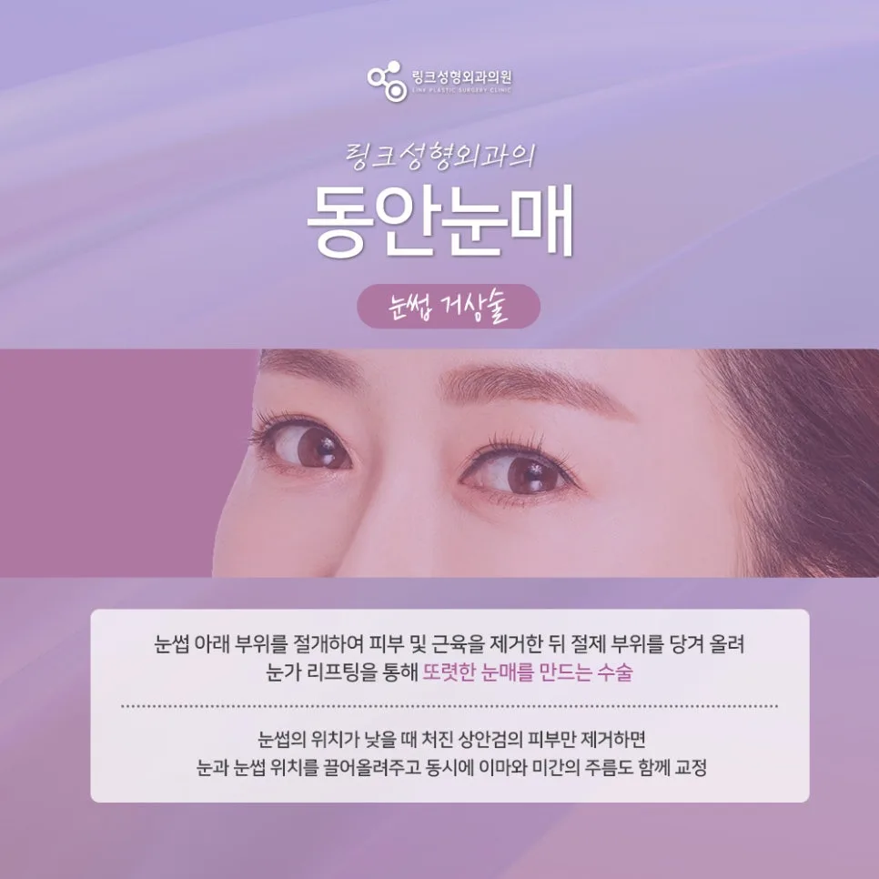 눈썹거상 관련 이미지