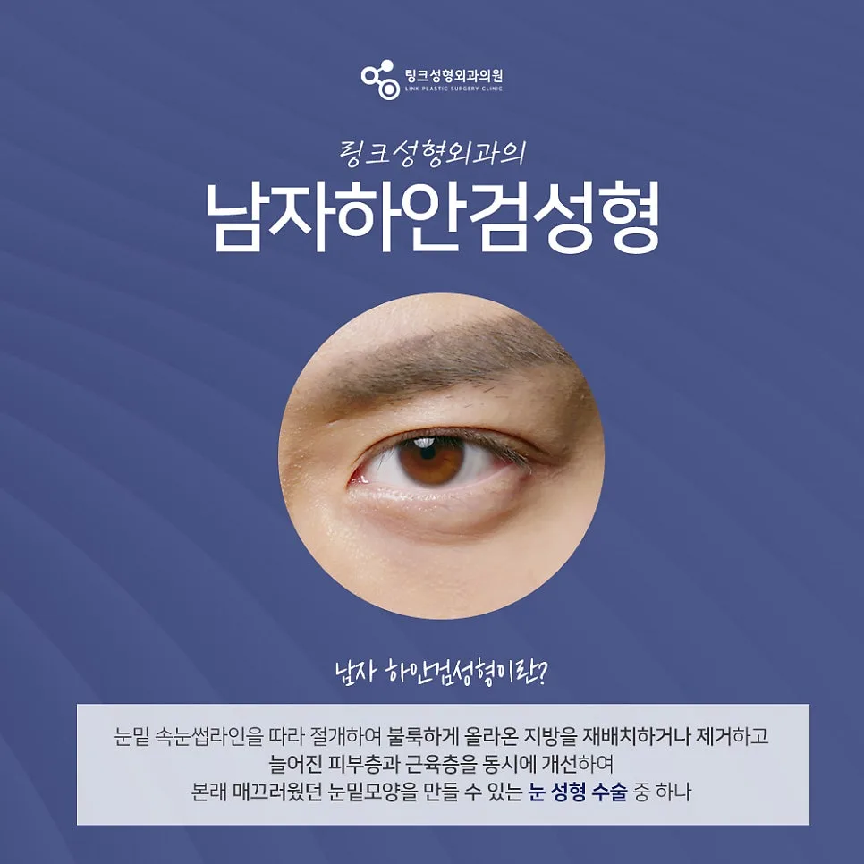 하안검 관련 이미지