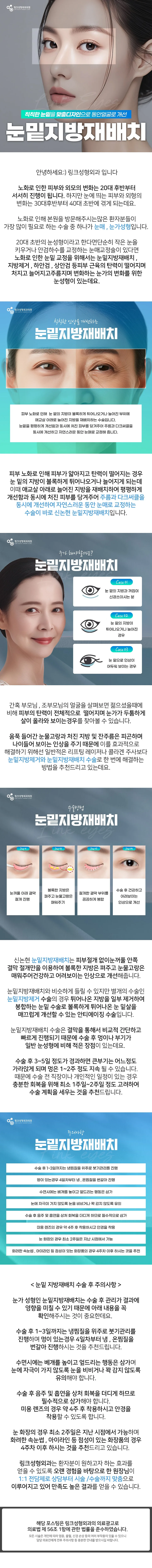 눈밑지방재배치 관련 이미지