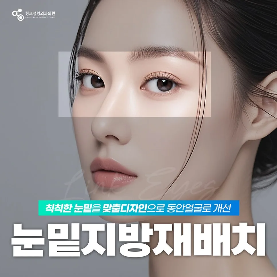 눈밑지방재배치 관련 이미지