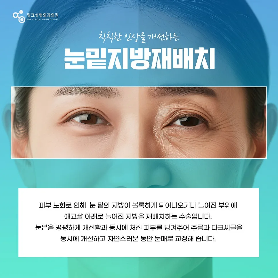 눈밑지방재배치 관련 이미지