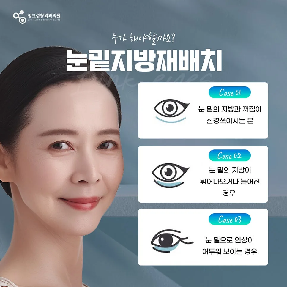 눈밑지방재배치 관련 이미지