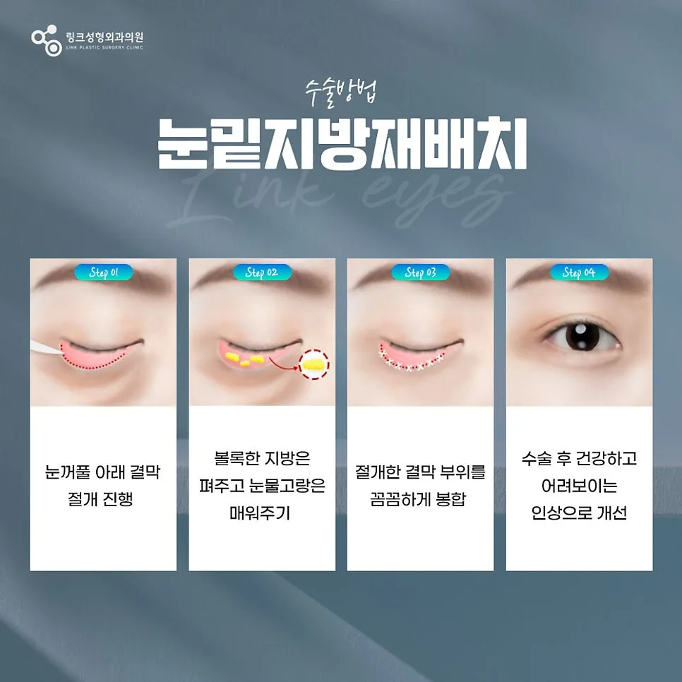 눈밑지방재배치 관련 이미지