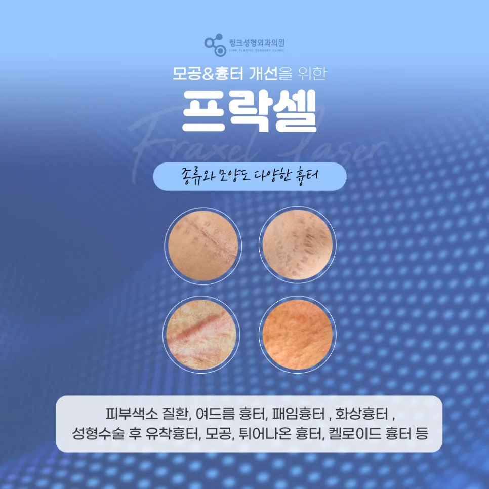 프락셀 관련 이미지