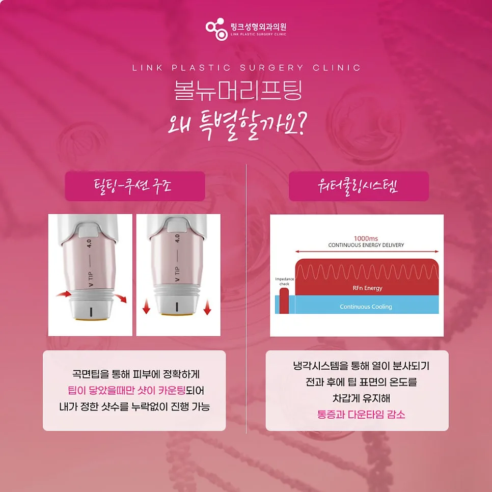 볼뉴머 관련 이미지