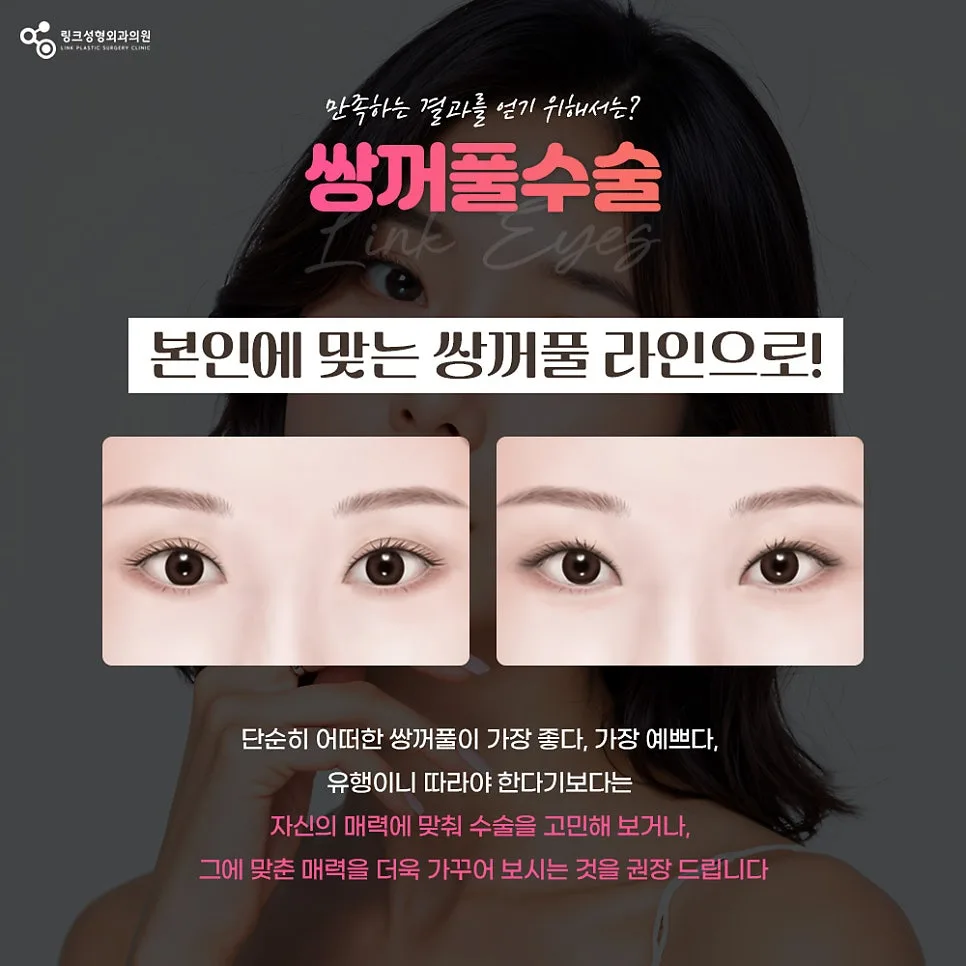 쌍꺼풀종류 관련 이미지