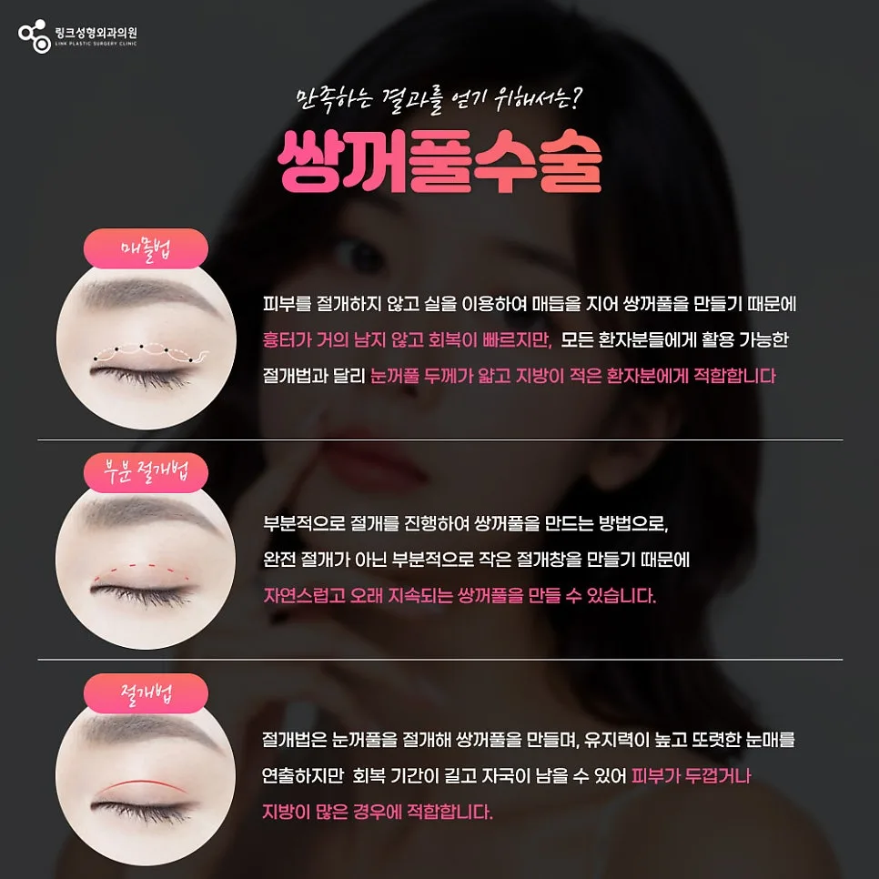 쌍꺼풀종류 관련 이미지