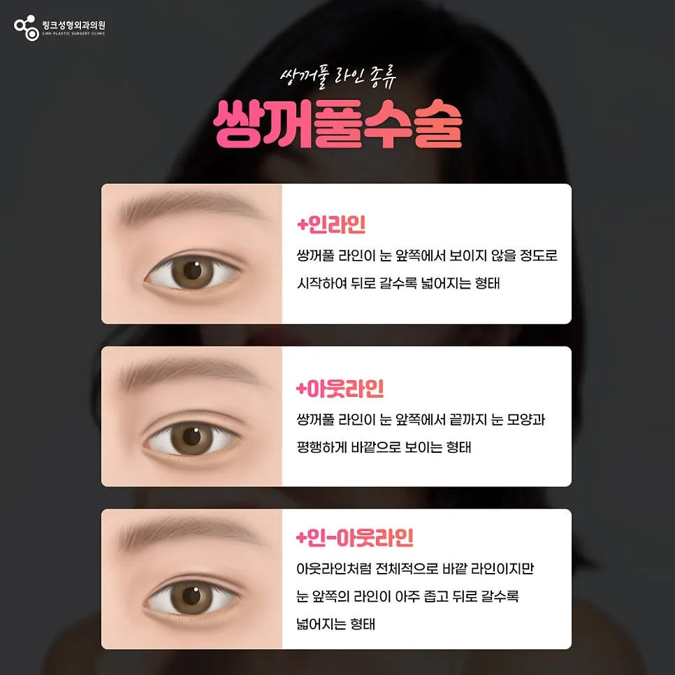 쌍꺼풀종류 관련 이미지
