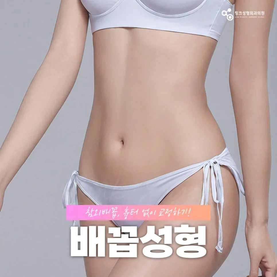 배꼽성형 관련 이미지