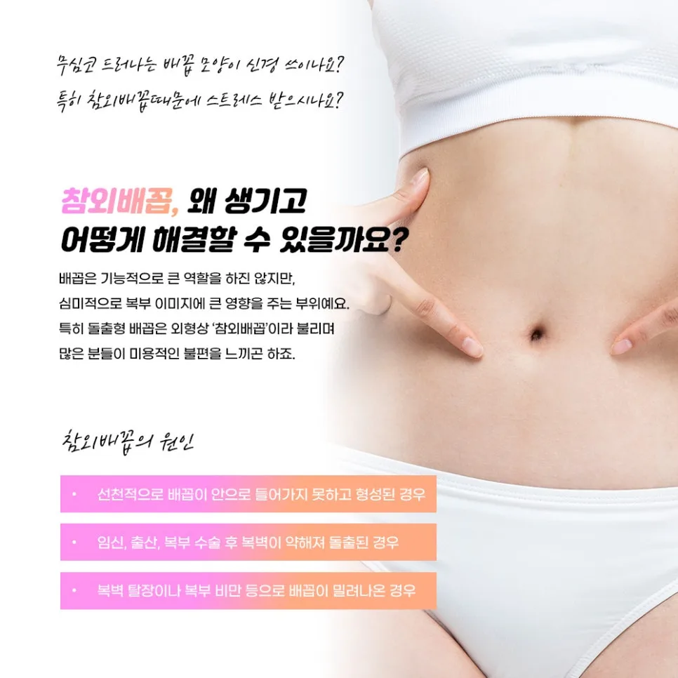 배꼽성형 관련 이미지