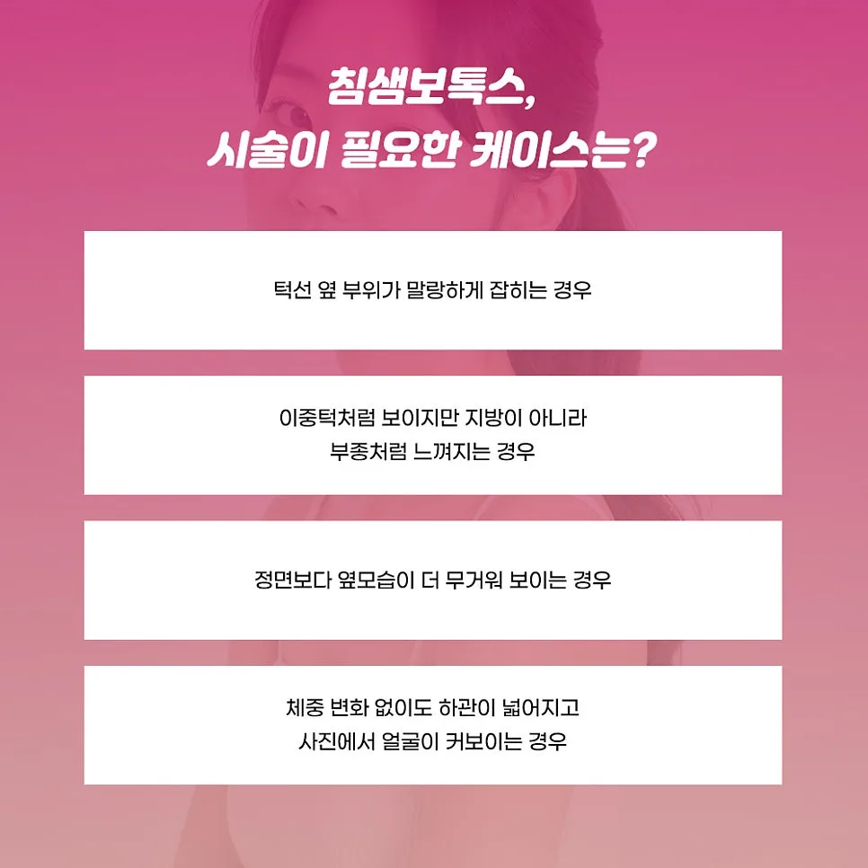 침샘보톡스 관련 이미지