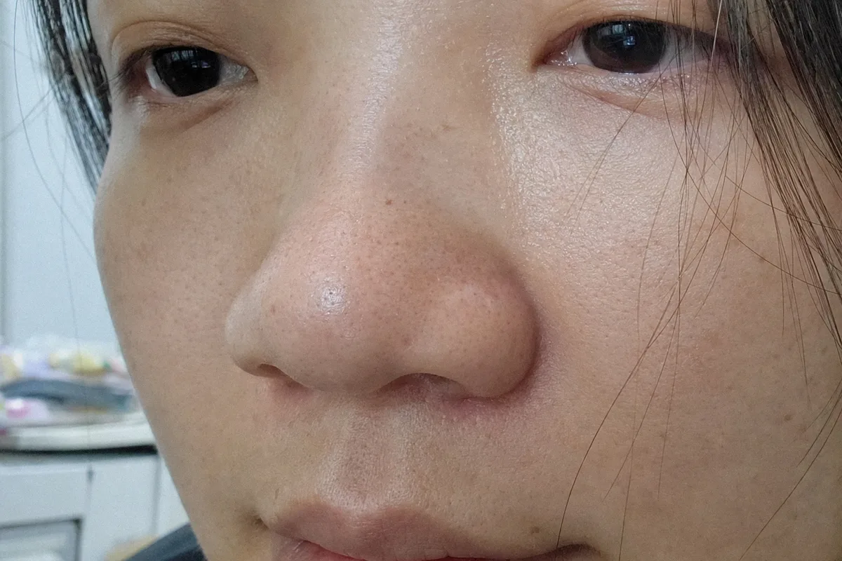 복코 관련 이미지